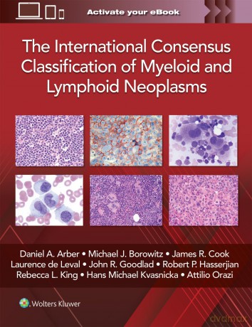 The International Consensus Classification of Myeloid and Lymphoid Neoplasms - Daniel A. Arber [KSIĄŻKA]