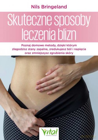 Skuteczne sposoby leczenia blizn - Nils Bringeland [KSIĄŻKA]