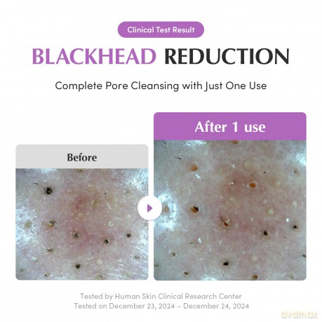 Eqqualberry - Purple Rice Pore Purifying Pack Cleanser - Purple - 130 ml