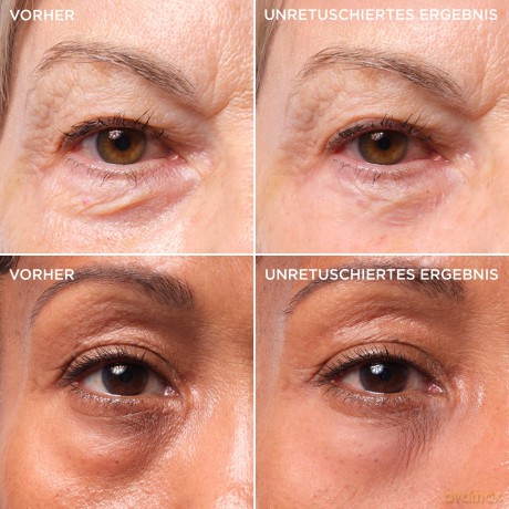 IT Cosmetics - Bye Bye Under Eye Bags 15 ml