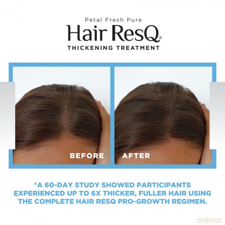 Petal Fresh - Hair ResQ Thickening Original Formula Conditioner - 355 ml.