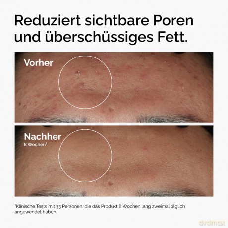 The Ordinary Niacinamide 10% + Zinc 1% 30ml