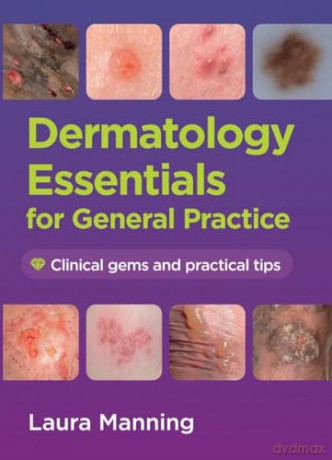 Dermatology Essentials for General Practice: Clinical Gems and Practical Tips - Laura Manning [KSIĄŻKA]