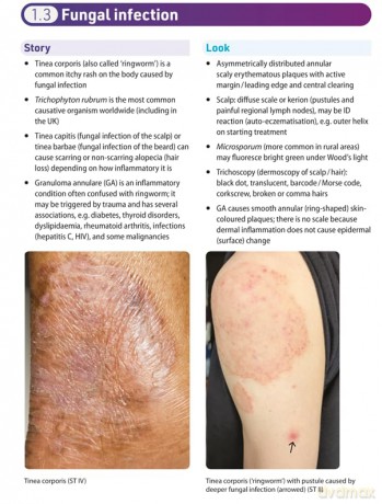 Dermatology Essentials for General Practice: Clinical Gems and Practical Tips - Laura Manning [KSIĄŻKA]