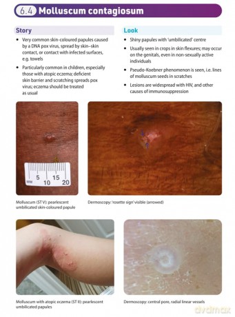 Dermatology Essentials for General Practice: Clinical Gems and Practical Tips - Laura Manning [KSIĄŻKA]