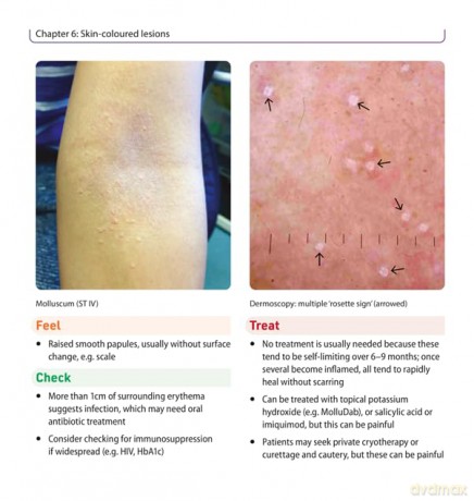 Dermatology Essentials for General Practice: Clinical Gems and Practical Tips - Laura Manning [KSIĄŻKA]