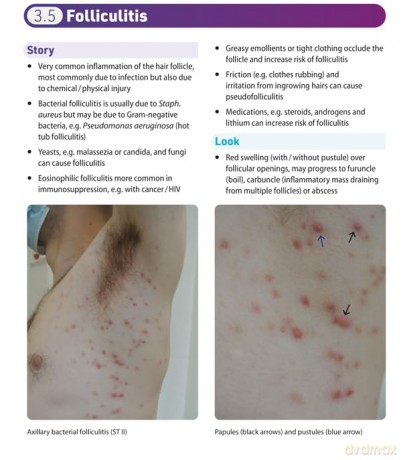 Dermatology Essentials for General Practice: Clinical Gems and Practical Tips - Laura Manning [KSIĄŻKA]