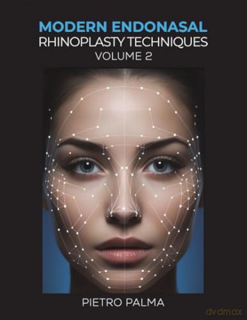 Modern Endonasal Rhinoplasty Techniques - Volume 2 - Pietro Palma [KSIĄŻKA]