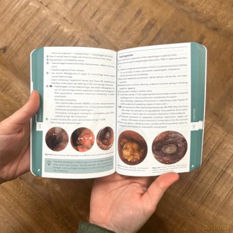 Pocket Gastroenterology and Hepatology: Your compact guide to Gastroenterology and Hepatology: practical, concise, and a clinical lifeline. (Compendium Medicine) [KSIĄŻKA]