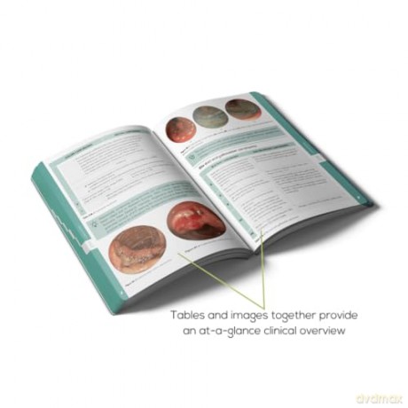 Pocket Gastroenterology and Hepatology: Your compact guide to Gastroenterology and Hepatology: practical, concise, and a clinical lifeline. (Compendium Medicine) [KSIĄŻKA]