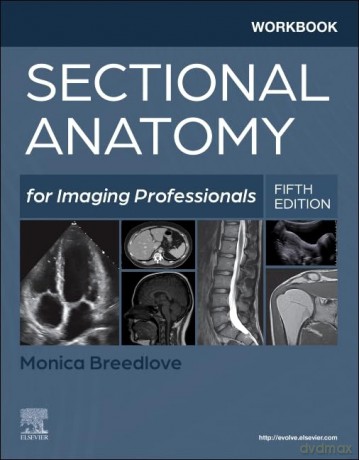 Workbook for Sectional Anatomy for Imaging Professionals - Monica Breedlove [KSIĄŻKA]