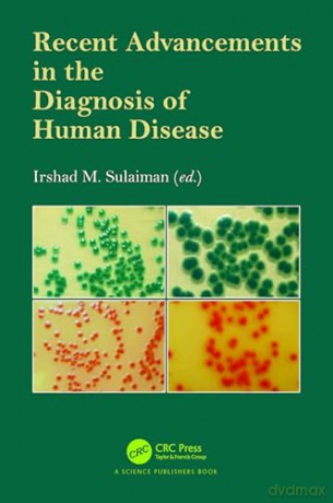 Recent Advancements in the Diagnosis of Human Disease - Irshad M. Sulaiman [KSIĄŻKA]