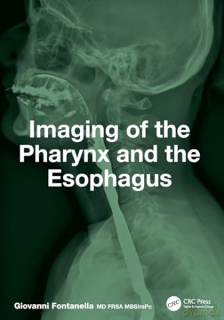 Imaging of the Pharynx and the Esophagus - Giovanni Fontanella [KSIĄŻKA]