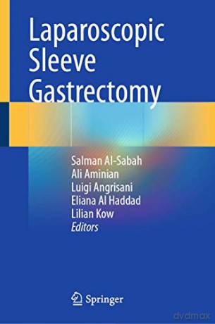 Laparoscopic Sleeve Gastrectomy - Salman Al-Sabah [KSIĄŻKA]