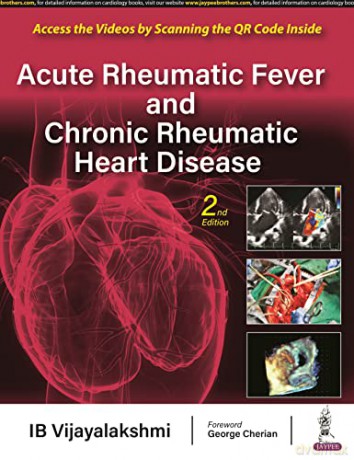 Acute Rheumatic Fever and Chronic Rheumatic Heart Disease - IB Vijayalakshmi [KSIĄŻKA]