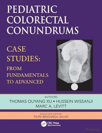 Pediatric Colorectal Conundrums: Case Studies: From Fundamental to Advanced (Pediatric Colorectal Surgery) - Marc Levitt [KSIĄŻKA]