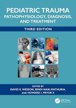 Pediatric Trauma: Pathophysiology, Diagnosis, and Treatment - David E. Wesson [KSIĄŻKA]