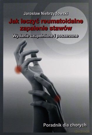 Jak leczyć reumatoidalne zapalenie stawów [KSIĄŻKA]