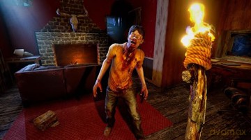 7 Days to Die - Console Edition - Survival Bundle [GRA XBOX SERIES X]