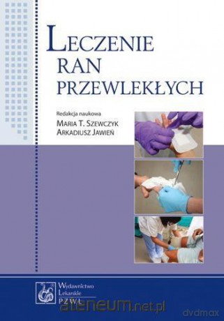 Leczenie ran przewlekłych [KSIĄŻKA]