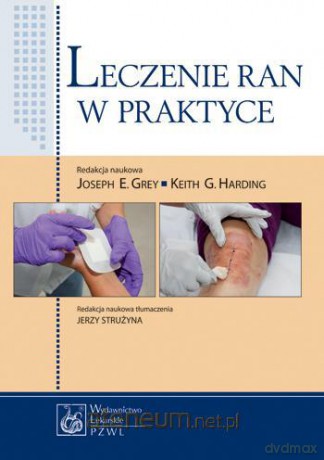 Leczenie ran w praktyce PZWL [KSIĄŻKA]