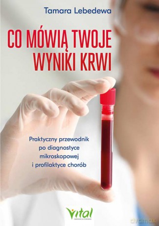 Co mówią twoje wyniki krwi. Praktyczny przewodnik po diagnostyce mikroskopowej i profilaktyce chorób - Tamara Lebedewa [KSIĄŻKA]