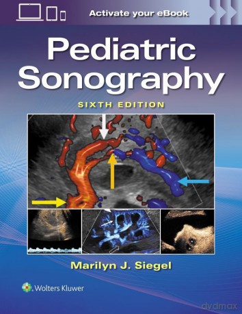 Pediatric Sonography - Marilyn Joy Siegel [KSIĄŻKA]