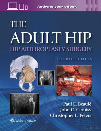 The Adult Hip: Hip Arthroplasty Surgery Print + eBook with Multimedia - Paul E. Beaule [KSIĄŻKA]