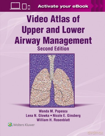 Video Atlas of Upper and Lower Airway Management: Print + eBook with Multimedia - Wanda M. Popescu [KSIĄŻKA]