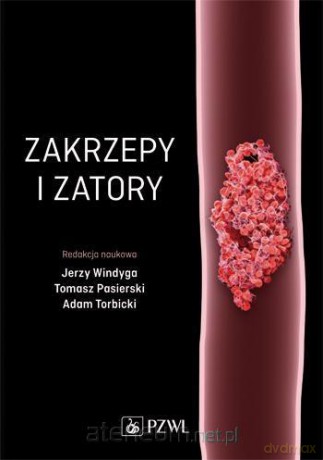 Zakrzepy i zatory [KSIĄŻKA]