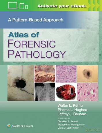 Atlas of Forensic Pathology: A Pattern Based Approach: Print + eBook with Multimedia - Walter L. Kemp [KSIĄŻKA]
