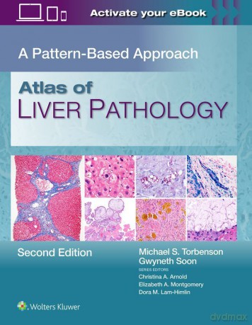 Atlas of Liver Pathology - Michael Scott Torbenson [KSIĄŻKA]