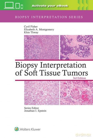 Biopsy Interpretation of Soft Tissue Tumors: Print + eBook with Multimedia - Cyril Fisher [KSIĄŻKA]