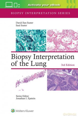 Biopsy Interpretation of the Lung - David Ilan Suster [KSIĄŻKA]