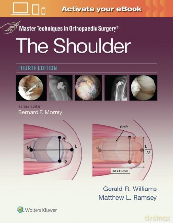 Master Techniques in Orthopaedic Surgery: The Shoulder: Print + eBook with Multimedia - Gerald R. Williams [KSIĄŻKA]