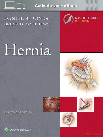 Master Techniques in Surgery: Hernia: Print + eBook with Multimedia - Daniel B Jones [KSIĄŻKA]