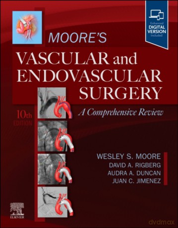 Moore's Vascular and Endovascular Surgery. A Comprehensive Review - Wesley S. Moore [KSIĄŻKA]