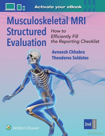 Musculoskeletal MRI Structured Evaluation - Avneesh Chhabra [KSIĄŻKA]
