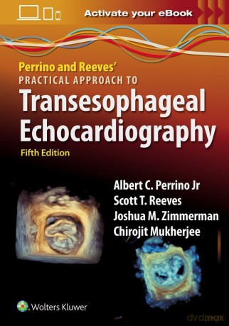 Perrino and Reeves' Practical Approach to Transesophageal Echocardiography - Albert C. Perrino [KSIĄŻKA]