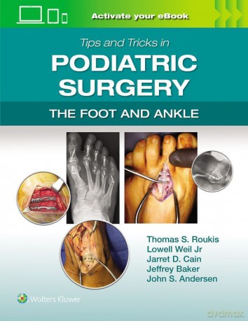 Tips and Tricks in Podiatric Surgery: The Foot and Ankle: Print + eBook with Multimedia - Thomas S. Roukis [KSIĄŻKA]