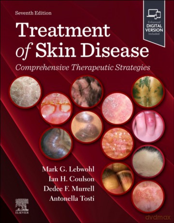 Treatment of Skin Disease: Comprehensive Therapeutic Strategies [KSIĄŻKA]