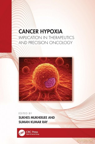 Cancer Hypoxia: Implication in Therapeutics and Precision Oncology - Mukherjee Sukhes [KSIĄŻKA]