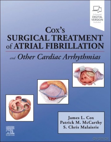 Cox's Surgical Treatment of Atrial Fibrillation - James Cox [KSIĄŻKA]
