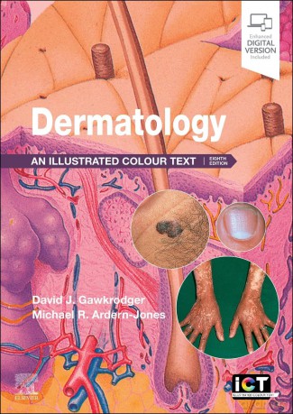 Dermatology: An Illustrated Colour Text [KSIĄŻKA]