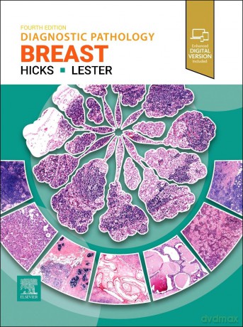 Diagnostic Pathology: Breast - usan C. Lester [KSIĄŻKA]
