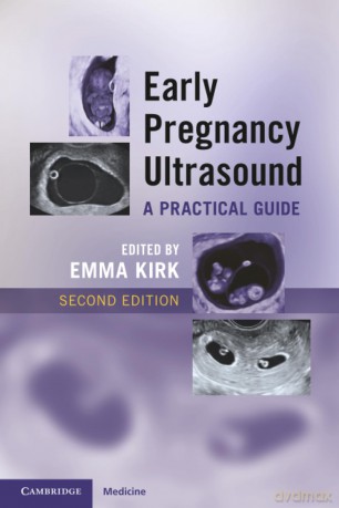 Early Pregnancy Ultrasound: A Practical Guide - Emma Kirk [KSIĄŻKA]