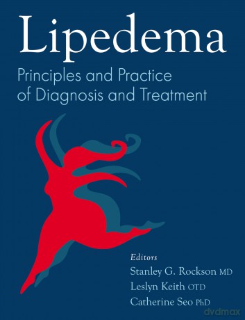 Lipedema: Principles and Practice of Diagnosis and Treatment - Stanley Rockson [KSIĄŻKA]