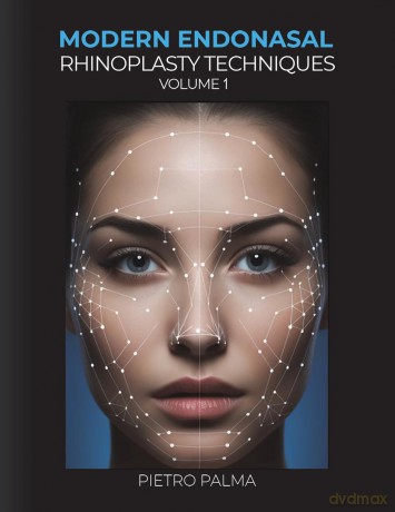 Modern Endonasal Rhinoplasty Techniques - Volume 1 - Pietro Palma [KSIĄŻKA]