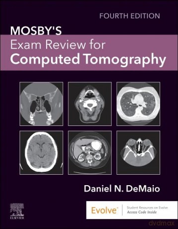 Mosby's Exam Review for Computed Tomography - aniel N. Demaio [KSIĄŻKA]