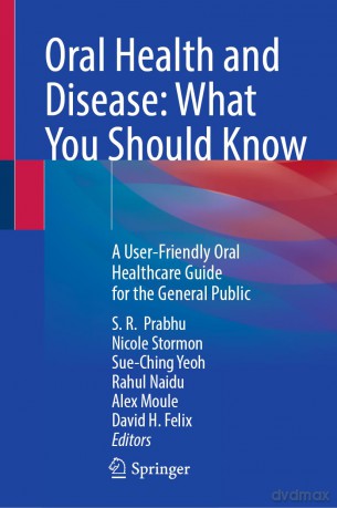 Oral Health and Disease: What You Should Know: A User-Friendly Oral Healthcare Guide for the General Public - S. R. Prabhu [KSIĄŻKA]